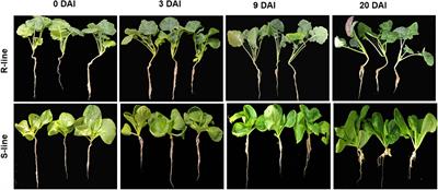 Root Transcriptome and Metabolome Profiling Reveal Key Phytohormone-Related Genes and Pathways Involved Clubroot Resistance in Brassica rapa L.